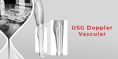 USG Doppler Vascular